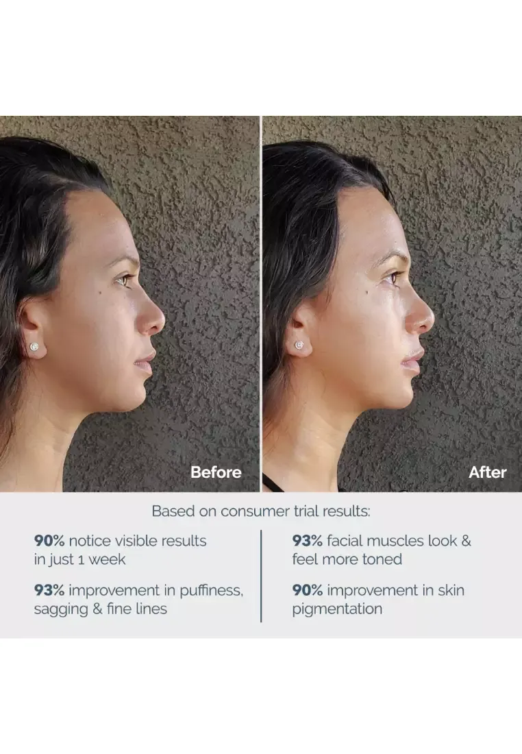 Foreo bear before and after.webp