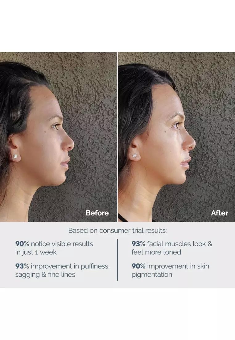 Foreo bear before and after_jpg.jpeg