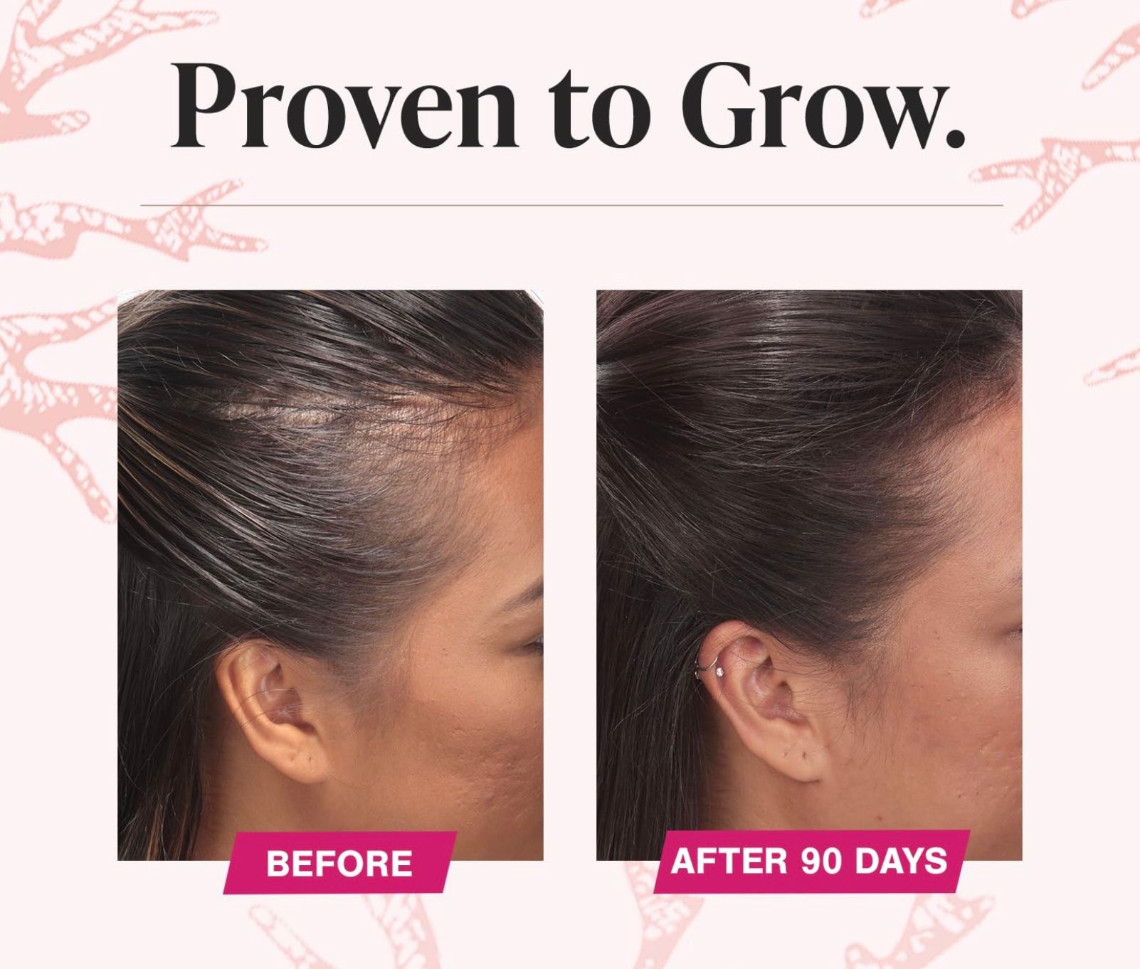 Viviscal before&after.jpg