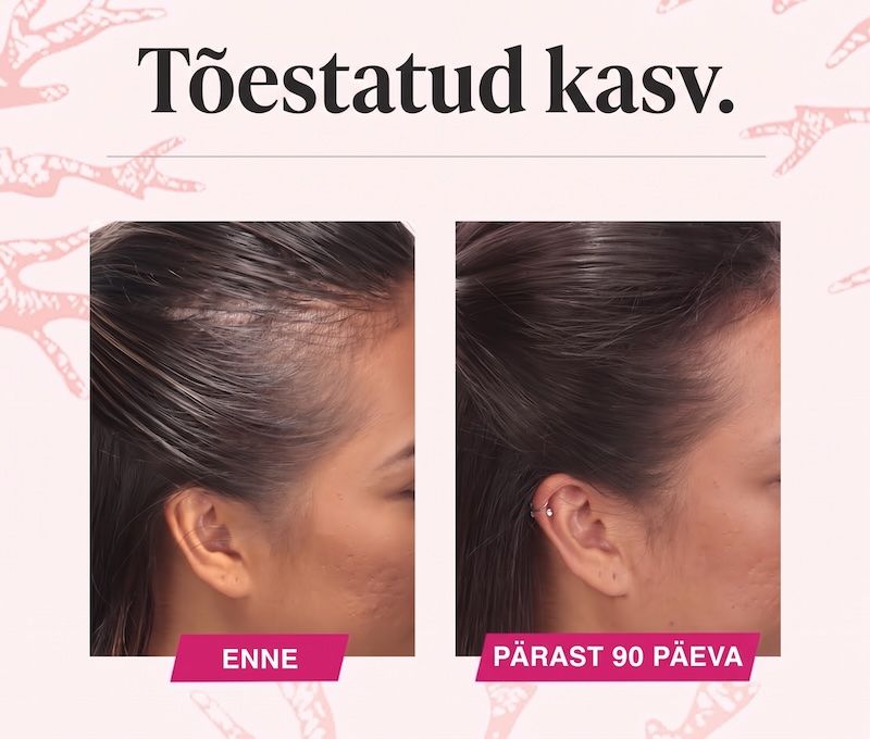 Viviscal enne&pärast.jpeg
